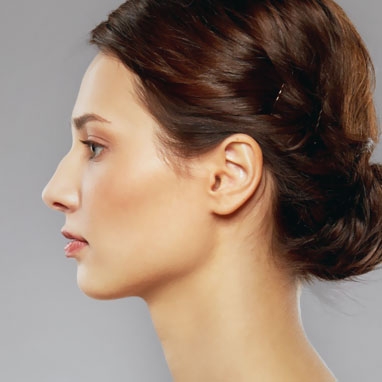 Nasenkorrektur Nase Ästhetische